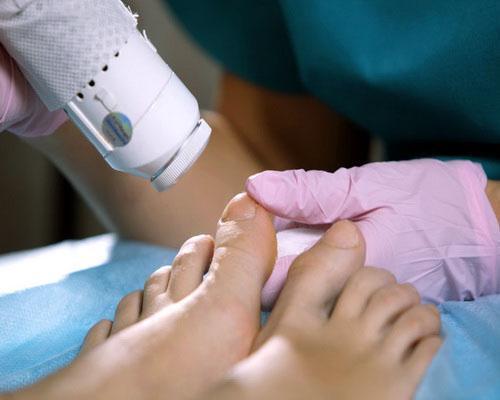 Грибок ногтей (онихомикоз) — причины, симптомы, лечение